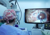 全国首台强生眼力健TECNIS? Toric II植入手术成功开展
